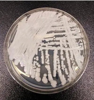 カンジダ・オーリス：弱った免疫系への新たな脅威