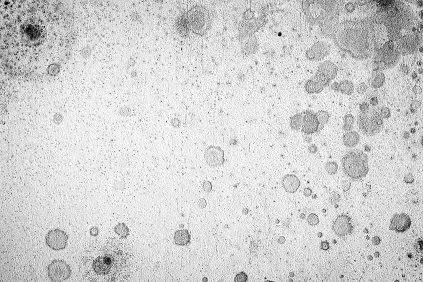 カビは人を殺すのか？