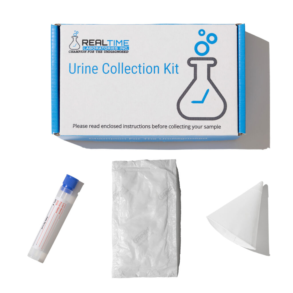 Buy Mycotoxin Urine Test Kit Online Realtime Labs