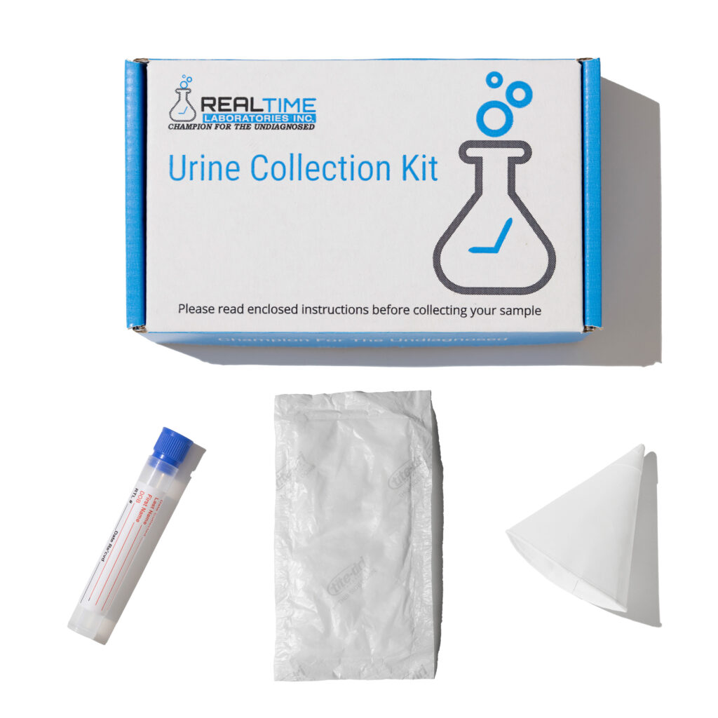 Mycotoxin Urine Test For Mold Reliable Supplier Cottonwoodcampbighorn